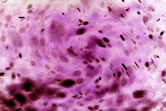 Invasion_5705